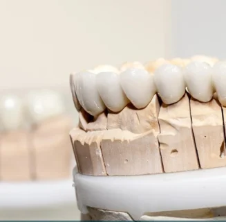 Zirconia and E-max dental crowns and bridges